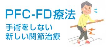 手術をしない関節治療 PFC-FD療法